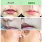 ACHETEZ-EN 2, OBTENEZ-EN 1 GRATUIT🤩Kit de crème dépilatoire pour femmes🤩