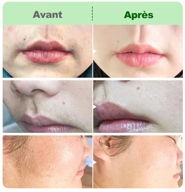 ACHETEZ-EN 2, OBTENEZ-EN 1 GRATUIT🤩Kit de crème dépilatoire pour femmes🤩