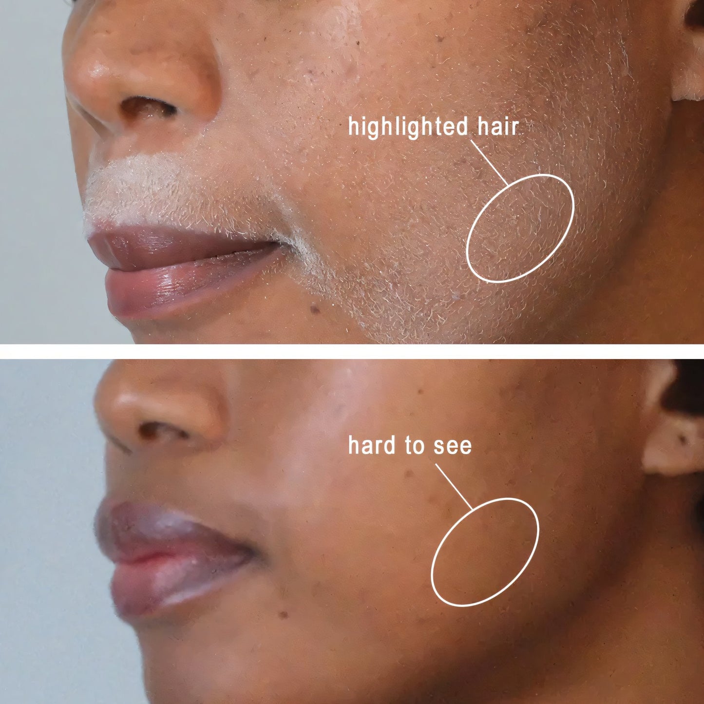 Haaridentificatiespray + Dermaplanerset