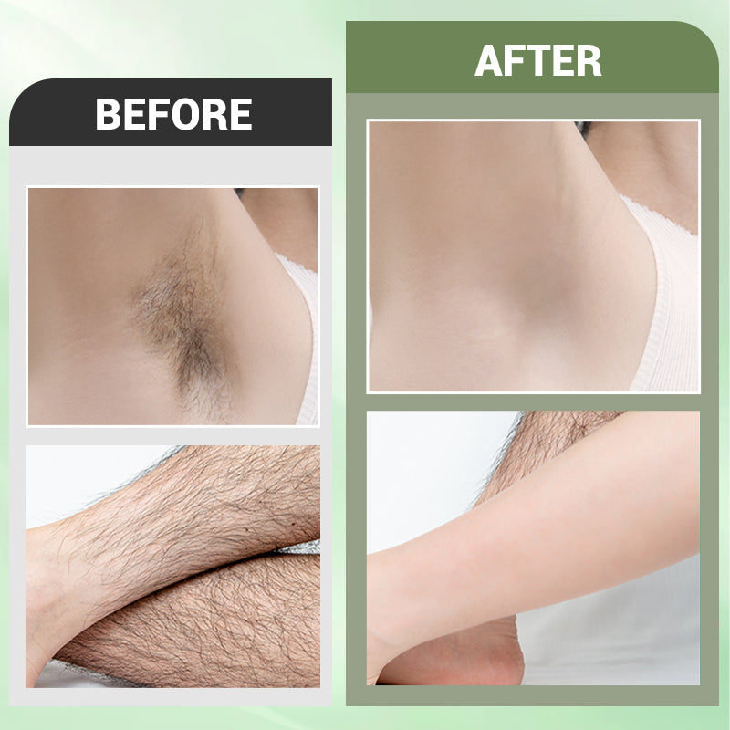 🔥🔥Achetez 3  obtenez 2 gratuit🎁 Set de crème dépilatoire 3PCS pour le corps entier